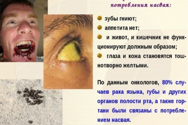 Как зарегистрироваться на кракене