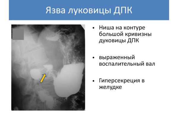 Kraken ссылка kraken clear com